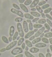 Yeast cells.jpg