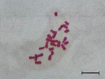 chromosomes clearly visible
