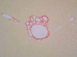 the original image, liver under microscope