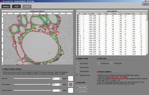 liver analyzed with Pixcavator, all contours obtained via thresholding