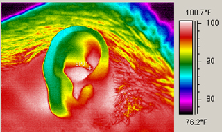 Human ear medical infrared thermography.jpg