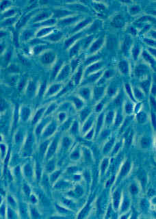 Human Umbilical Vein Endothelial Cells (HUVEC).jpg