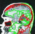 Brain 483 0.jpg