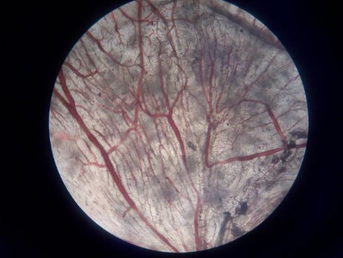 image of blood vessels nuder microscope