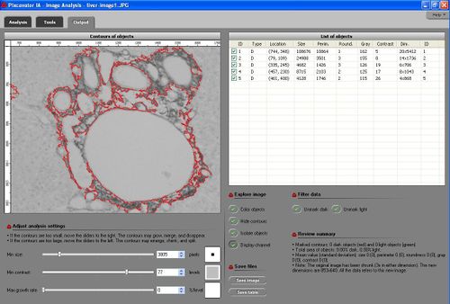 liver analyzed with Pixcavator, outer contours